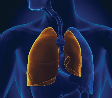 An X-ray showing a pair of lungs